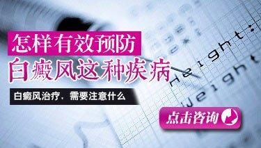 成都看白癜风哪里好？如何才能预防白斑再次出现呢?