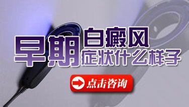 成都白癜风医院解答白癜风的早期症状有哪些呢?