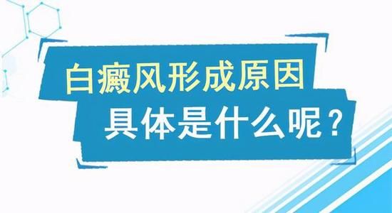 成都治白癜风的医院：面部白癜风的诱因是什么